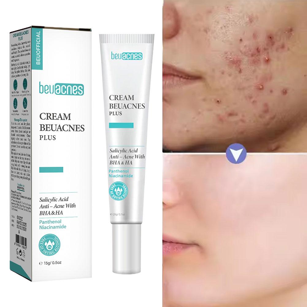 Skincare Niacinamide - 新しい 20 グラムナイアシンアミドにきびジェル抗にきびサリチル酸穏やかなクレンジングジェルオイルバランスディープクリーニングスキンケア製品女性