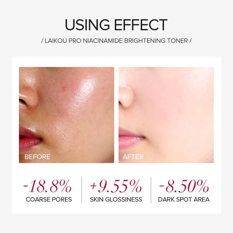 LAIKOU PRO ナイアシンアミド 4点セット ブライト - Skincare Niacinamide のレビューと価格
