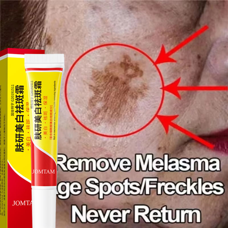 美白そばかすクリーム 顔のブライトニングクリーム ナイアシン - Skincare Niacinamide のレビューと価格