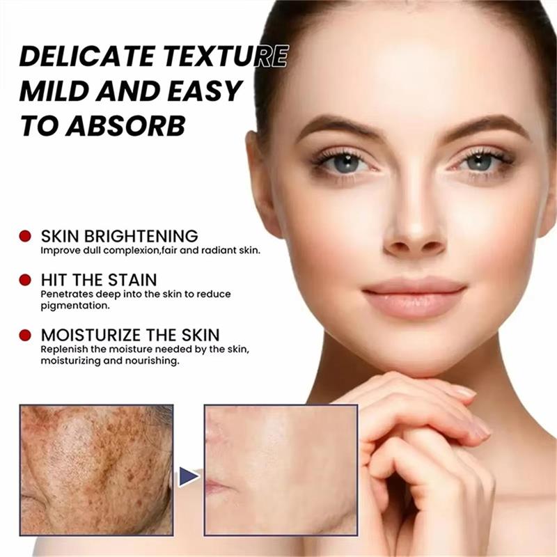 美白そばかすクリーム 顔のブライトニングクリーム ナイアシン - Skincare Niacinamide のレビューと価格